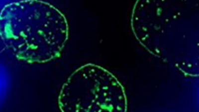 UP 09: Protocol for Live Cell Imaging of the Immune Synapse