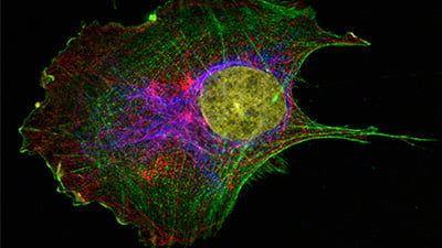 UP 10: Immunofluorescent Staining of Adherent Cells in the ibidi µ-Slide 8 Well