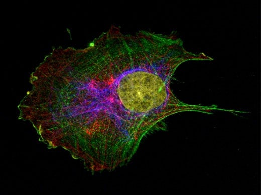 Immunofluorescent staining of adherent cells in the ibidi µ-Slide 8 Well