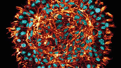 UP 11: Spheroid Culture, Staining, and Clearing for 3D Imaging