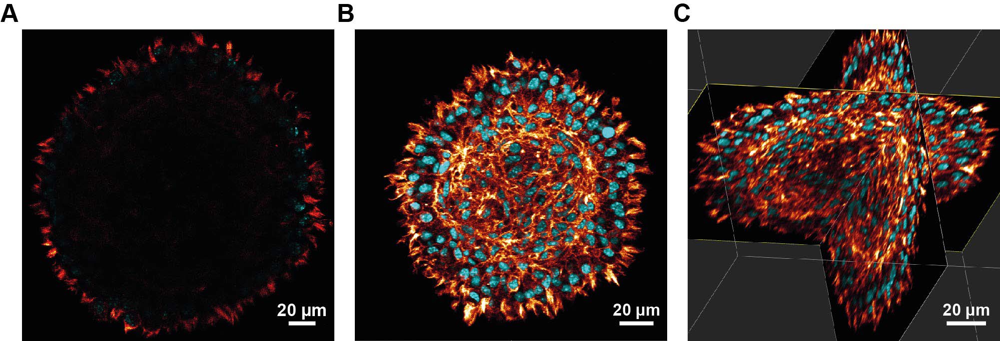Confocal microscopy of a stained L929 spheroid before and after clearing