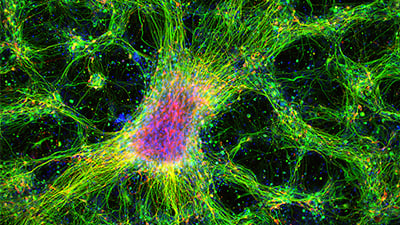 UP 13: Protocol for Immunofluorescent Staining of iPS Cell-Derived Dopaminergic Neurons in the ibidi μ-Plate 96 Well Black