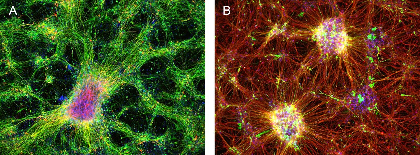 Immunofluorescence image of iPS cell-derived dopaminergic neurons in an ibidi µ-Plate 96 Well Black