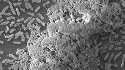 UP 14: Protocol for Bacterial Biofilm Visualization and Sample Preparation for Scanning Electron Microscopy