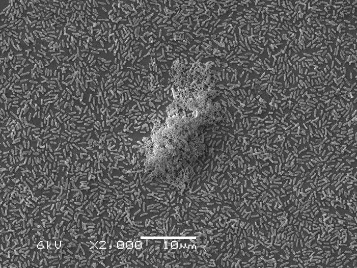 Scanning electron microscopy of Pseudomonas aeruginosa cells and biofilm at 2,000x magnification