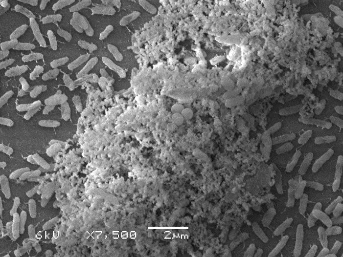 Scanning electron microscopy of Pseudomonas aeruginosa cells and biofilm at 7,500x magnification