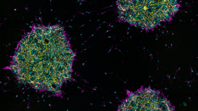 UP 15: Protocol for Generating Self-Organized Tubular Bile Duct Organoids from hiPSC-Derived Hepatobiliary Cells on the µ-Pattern ibiTreat