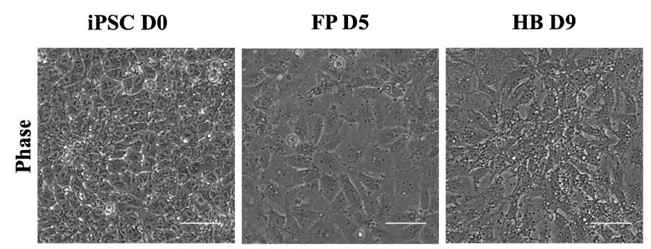 Differentiation of hiPSCs into hepatoblast cells