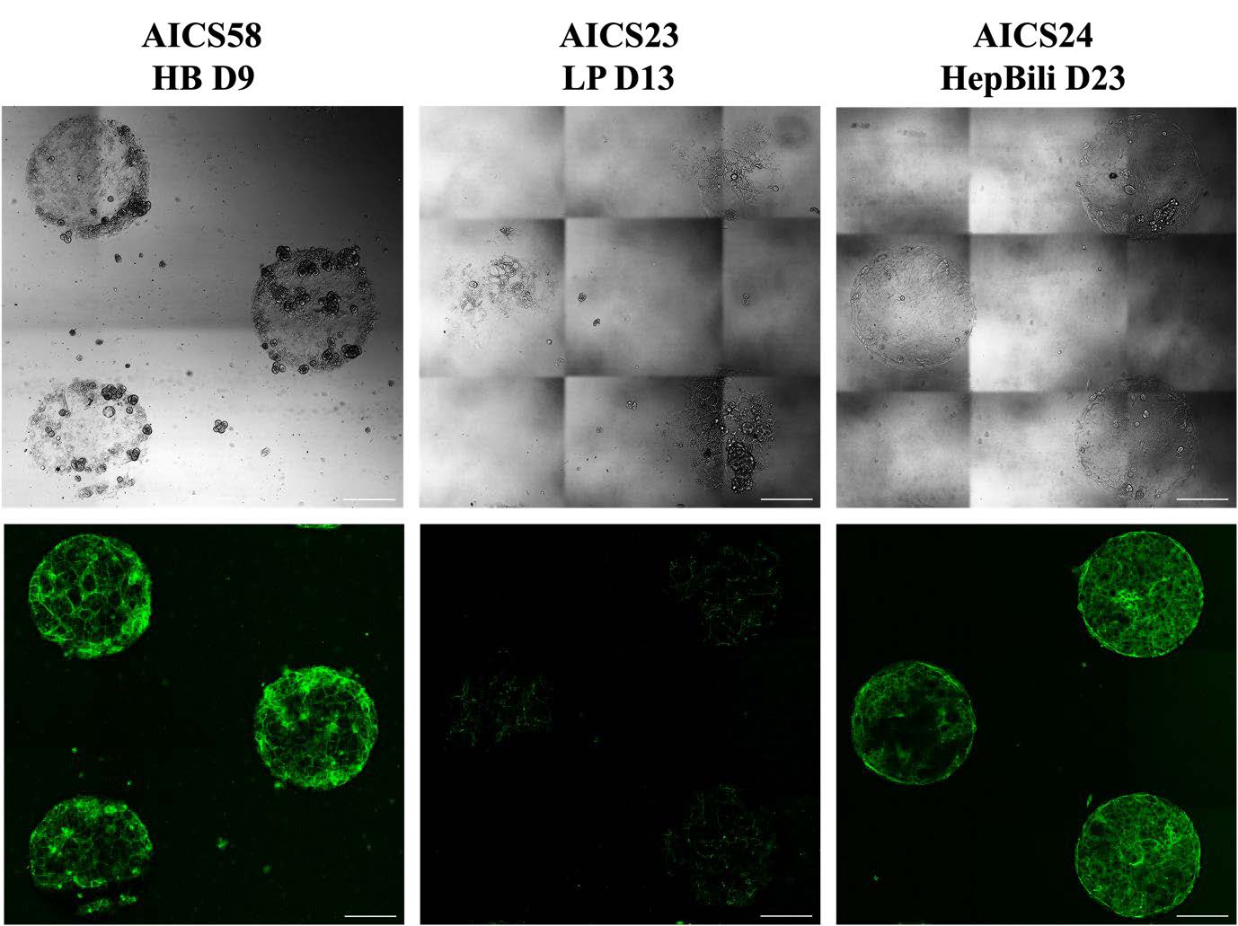 Differentiation to hepatobiliary cells on the µ-Pattern ibiTreat