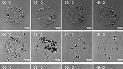 UP 16: Protocol for T Cell-Mediated Cell Killing Assay on the µ-Pattern ibiTreat