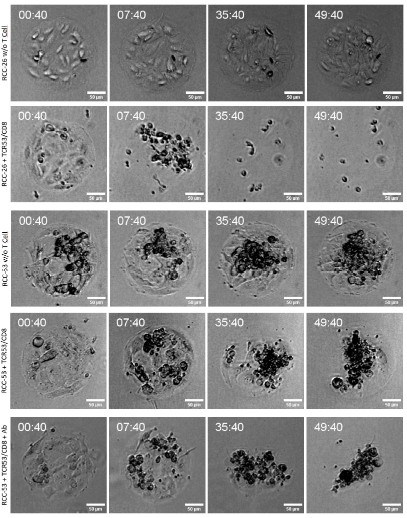 Time-lapse images of TCR53/CD8 T cell co-cultures with RCC-26 or RCC-53 tumor cells on µ-Pattern ibiTreat