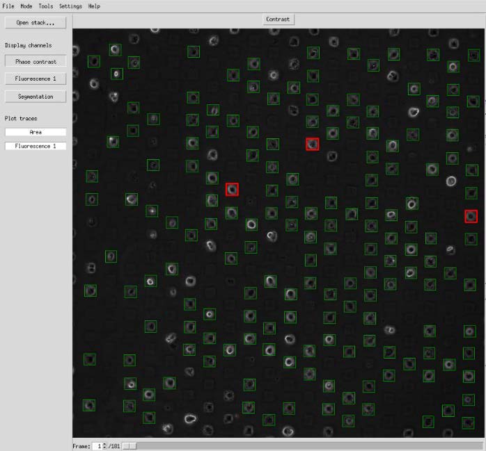 PyAMA overview image with analyzed single-cell spots marked on the µ-Pattern