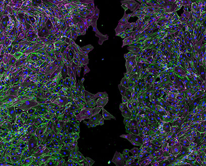 Endothelial cells cultured in an ibidi 35mm µ-Dish