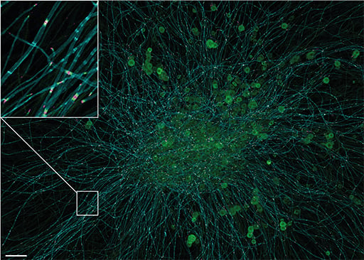 Confocal image of a murine dorsal root ganglion explant