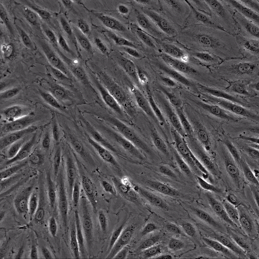 Neutrophils transmigrating through an endothelial monolayer
