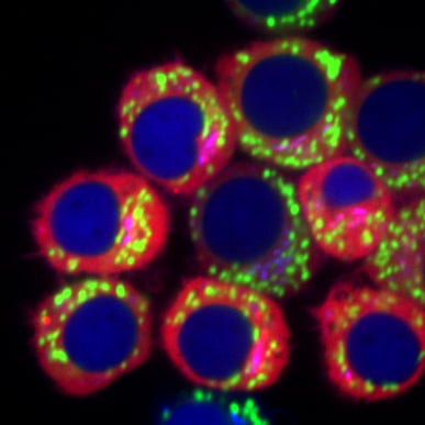 J774 mouse macrophages expressing a fusion of a fluorescent protein, the inflammasome sensor NLRP3 and a trans-Golgi network marker