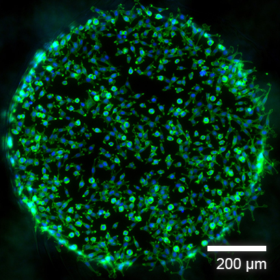 Fluorescence Microscopy of Adherent Cells