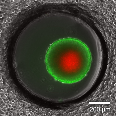 Live/Dead Staining of a Long-Term Cultured Spheroid