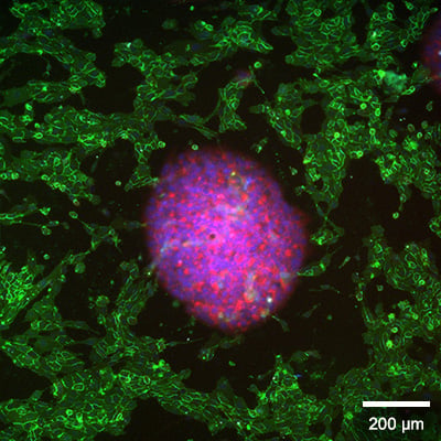 Spheroids and HUVECs in co-culture under perfusion