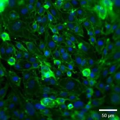 Widefield fluorescence microscopy of HUVECs on Collagen Type I, Rat Tail in the micro-Insert 3D