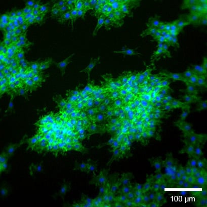 Widefield fluorescence microscopy of rat fibroblasts (Rat1) on Collagen Type I, Rat Tail in the micro-Insert 3D