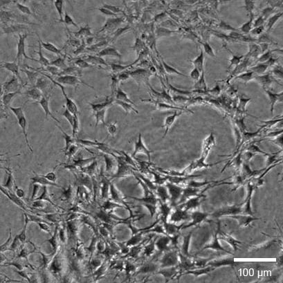 Phase contrast image of NIH3T3 cells on Collagen Type I, Rat Tail in the micro-Insert 3D