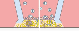 Potential advanced co-culture assay concept with the micro-Insert 3D