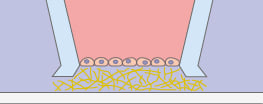 Potential barrier assay concept with the micro-Insert 3D