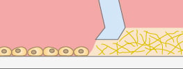 Cells cultured in the outer well surrounding the micro-Insert 3D