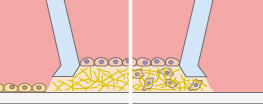 Potential co-culture assay concept with the micro-Insert 3D