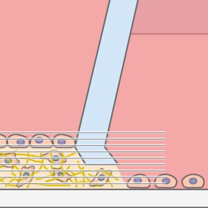 3D z-stack example image from cells cultured with the micro-Insert 3D