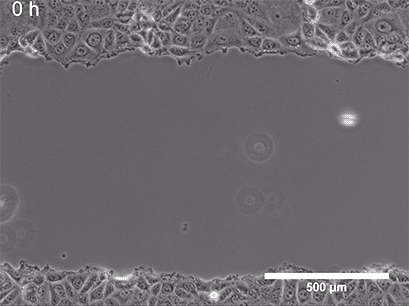 Culture-Insert 2 Well in µ-Dish 35 mm | Wound Healing Assays