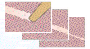 E_8XXXX_CI_2Well_scratch_assay.jpg