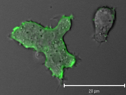 Live cell imaging of Dictyostelium discoideum