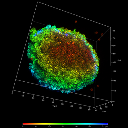 Confocal laser scanning image of an HT-1080 LifeAct spheroid