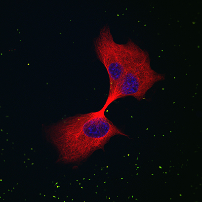Differentiated PC12 cells in a μ-Dish 35 mm, high, stained for ß-III-Tubulin (Covance, Princeton, USA) in red