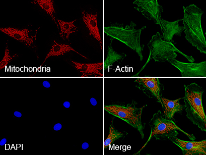 IF_bovine_endothelial_cells__RGB.jpg