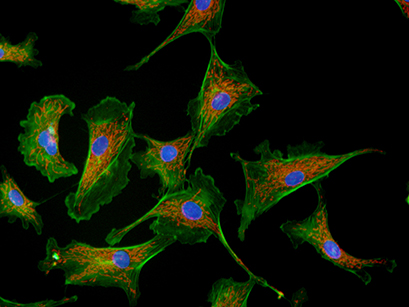 Widefield immunofluorescence image of bovine aortic endothelial cells