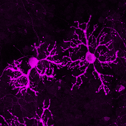Fluorescence microscopy image of murine cerebellar Purkinje neurons cultured in an ibidi µ-Dish 35 mm, low Grid-500. 