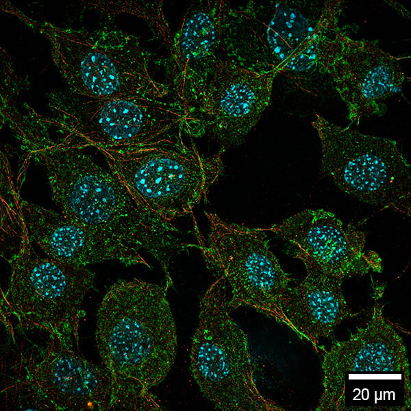 MCF7 cells in the µ-Slide 32 Well Glass Bottom