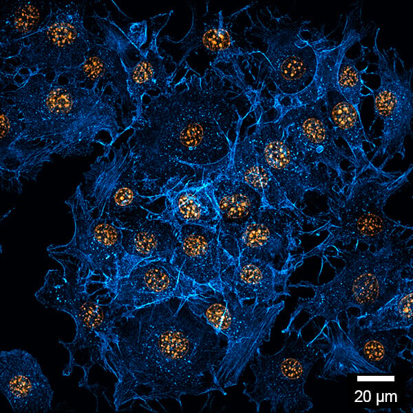 Widefield fluorescence image of NIH-3T3 cells cultivated in the µ-Slide 32 Well