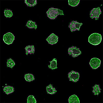 Liver Organoids