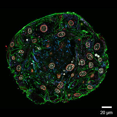 Spheroid Confocal Abberior