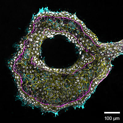 Organoid