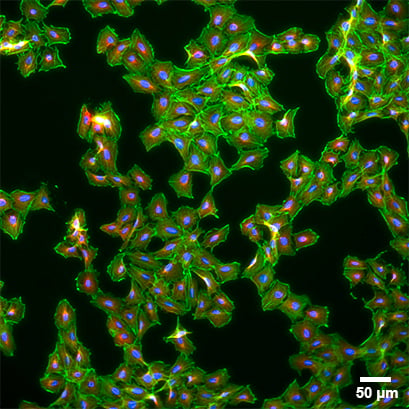 µ-Plate 24 Well | Black Walls & Flat Coverslip Bottom | ibidi