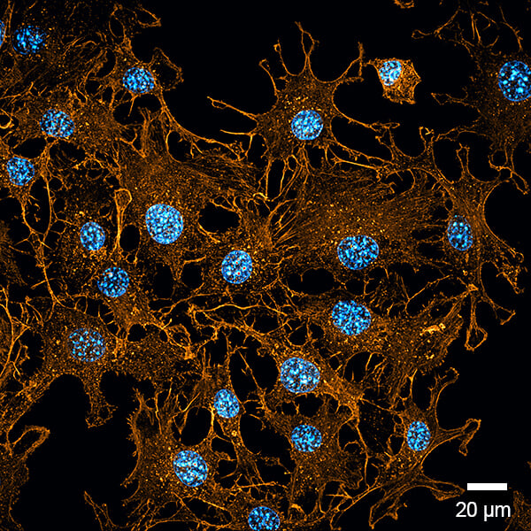 Widefield fluorescence image of NIH3T3 cells cultivated in the µ-Plate 48 Well