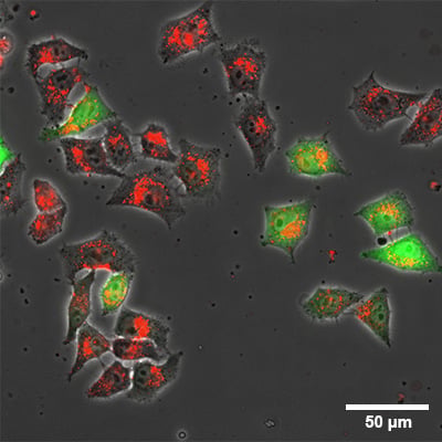 Live cell imaging of GFP-expressing Rat1 fibroblasts with rhodamine-labelled transfection reagent