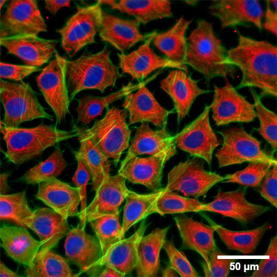 Immunofluorescence microscopy of Rat1 fibroblasts stained for alpha-tubulin, F-actin, and nuclei
