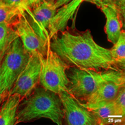 96 Well Plate Round | Microplate for Fluorescence Microscopy | ibidi