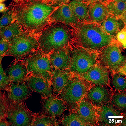 96 Well Plate Round | Microplate for Fluorescence Microscopy | ibidi